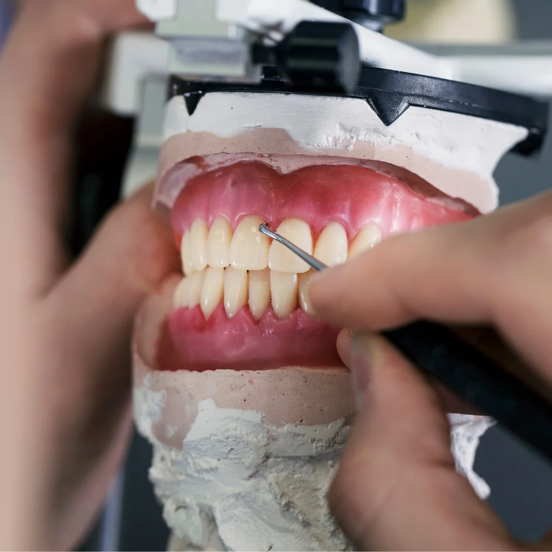 Dermatologia em João Pessoa -  Pr&oacute;teses Dent&aacute;rias